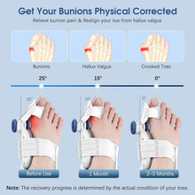 حمل الصورة داخل معرض الصور, مصحح إبهام القدم القابل للتعديل للنساء والرجال